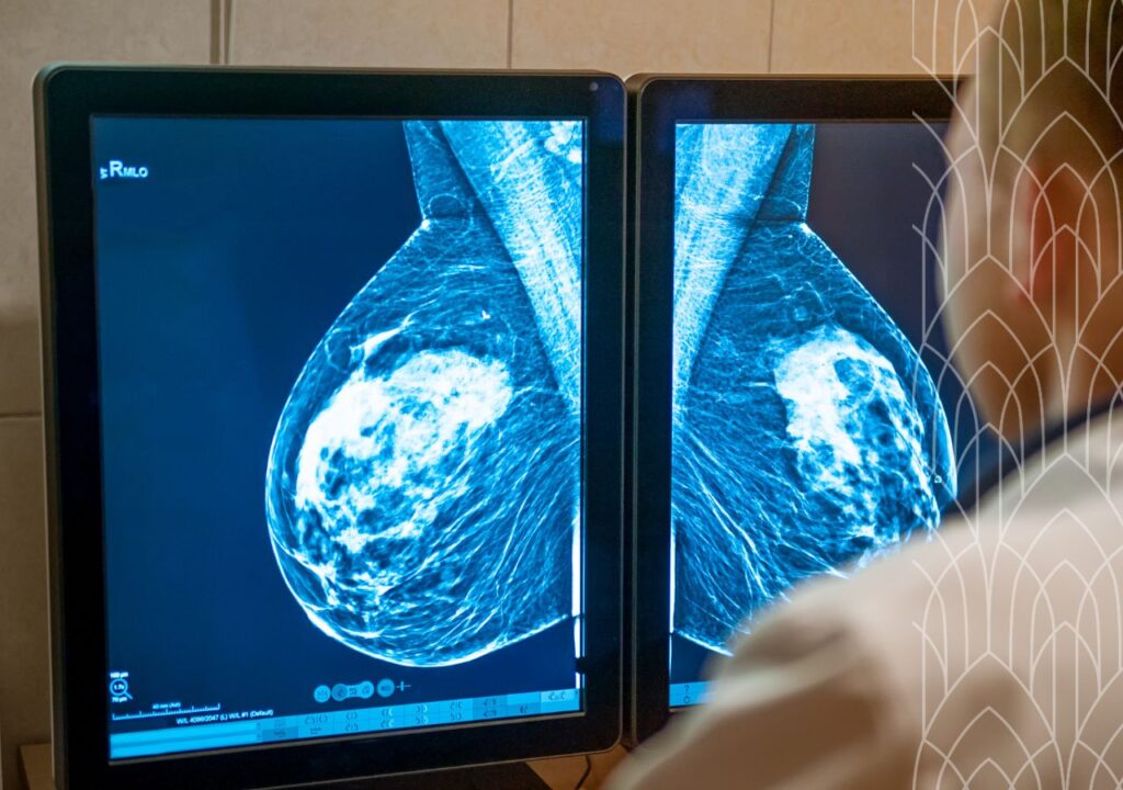 Brustkrebsvorsorge ab 50 – warum regelmäßige Untersuchungen so wichtig sind - Marienklinik Bozen Brustkrebsvorsorge ab 50 – warum regelmäßige Untersuchungen so wichtig sind - Marienklinik Bozen
